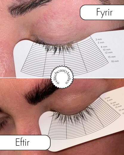 Augnhára serum